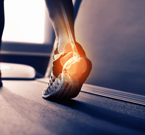Radiologic-Imaging-in-Sports-Injuries